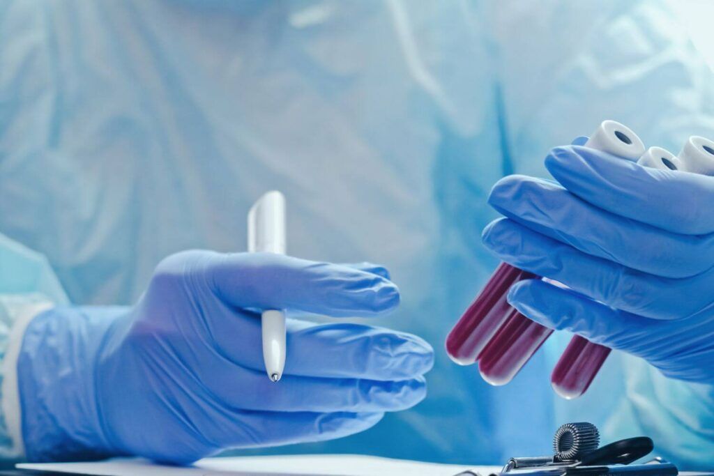 Examenes de sangre en Houston